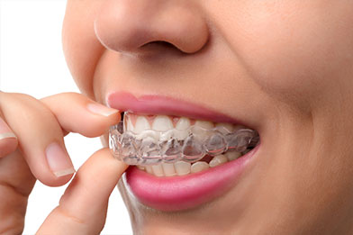 Invisalign™ Aligner Case Kansas City Chiefs – Invisalign USA Store